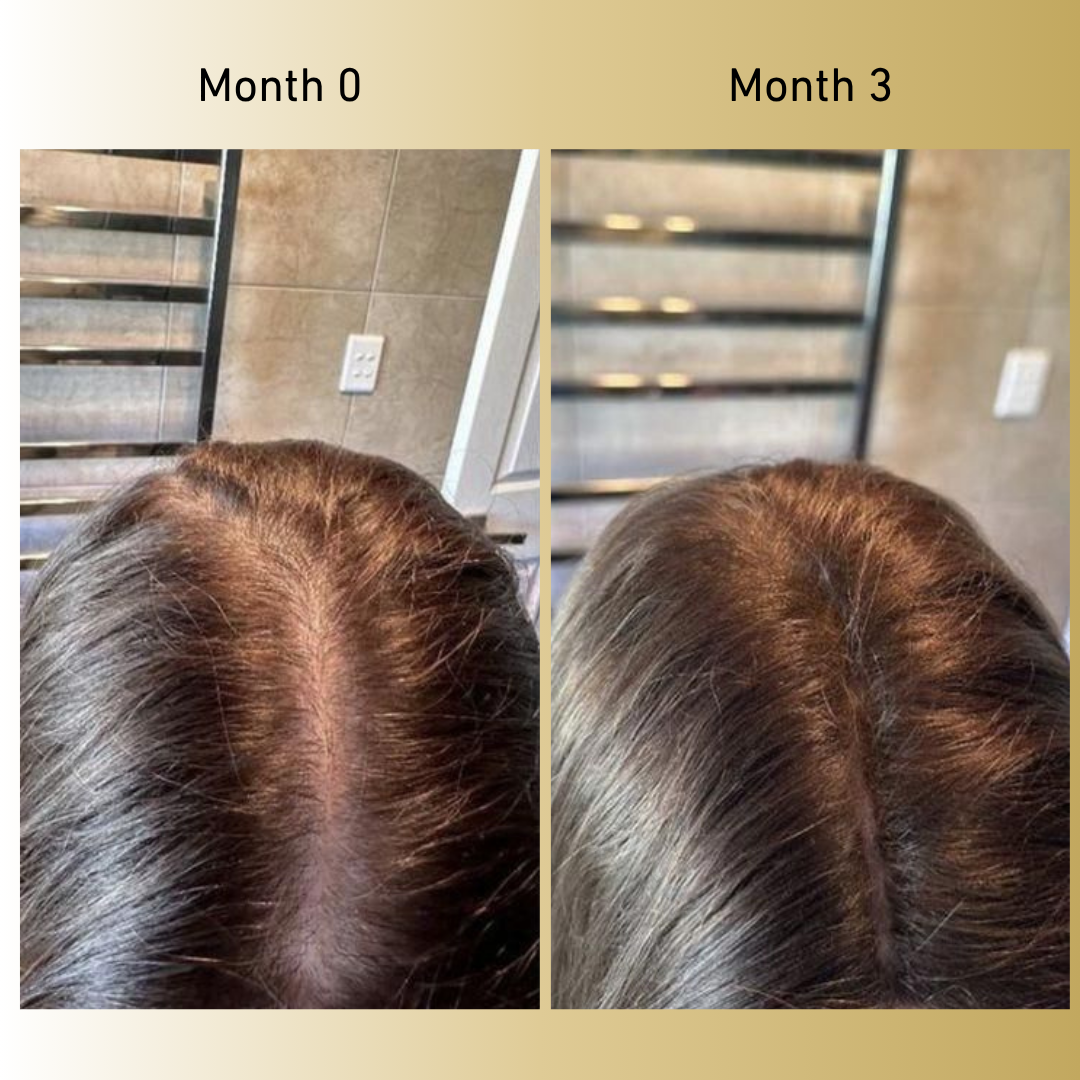 Veganic Growth™ Natural Hair Growth Oil