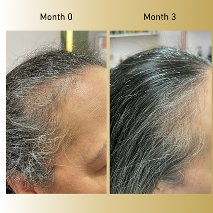 Veganic Growth™ Natural Hair Growth Oil