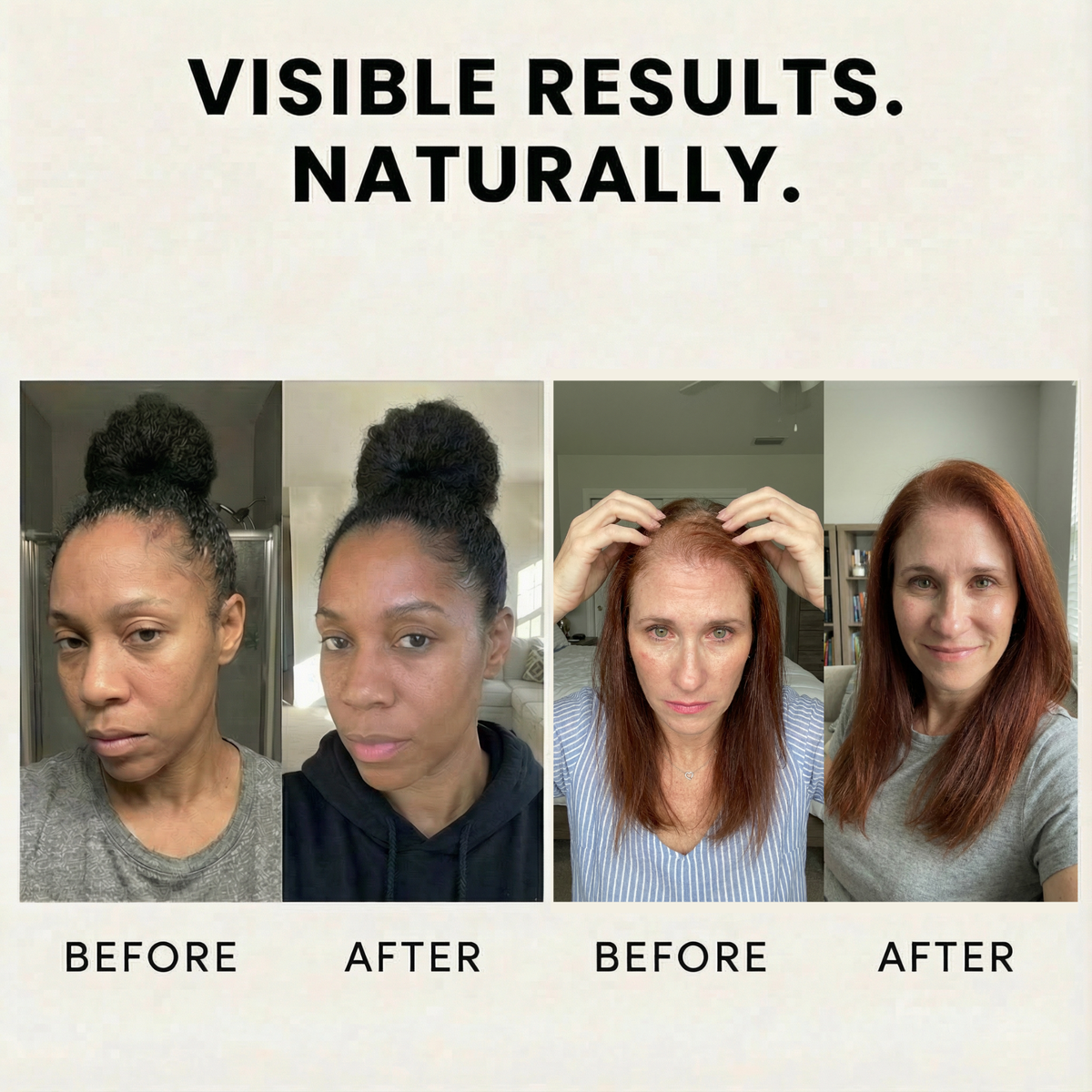 Veganic Growth™ Natural Hair Growth Oil - Full Treatment Bundle