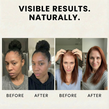 Veganic Growth™ Natural Hair Growth Oil - Full Treatment Bundle