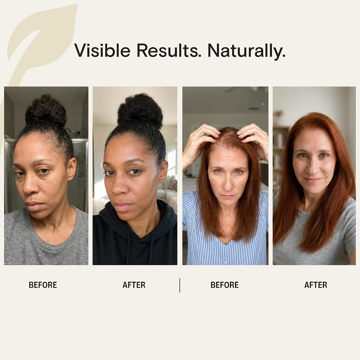 Veganic Growth™ Natural Hair Growth Oil