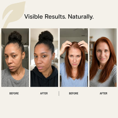 Veganic Growth™ Natural Hair Growth Oil